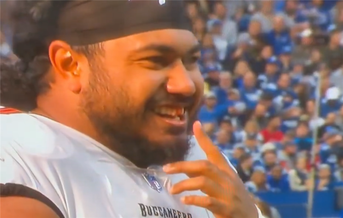 Colts vs. Buccaneers: Vita Vea loses a tooth and smiles