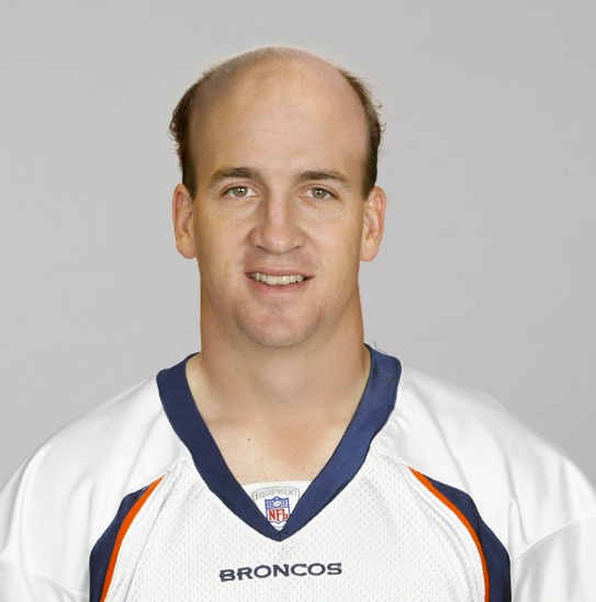 What would NFL quarterbacks look like bald?